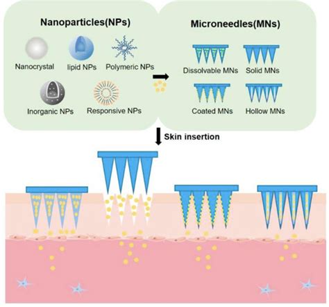 how to fabricate metal microneedle arrays|microneedle drug delivery system.